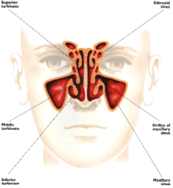/copyrighteous/images/sinus_diagram-small.png